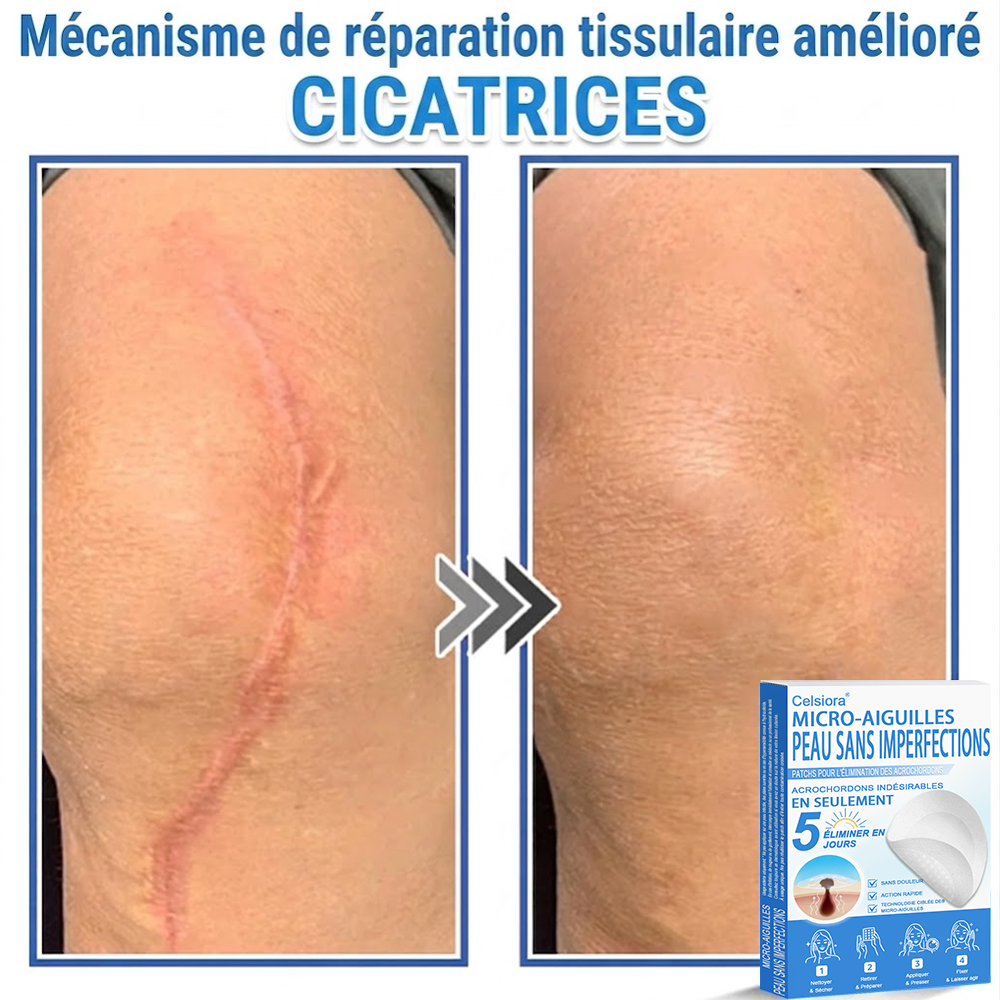 🌿Pansements hydrocolloïdes à micro-aiguilles Celsiora® 2-en-1