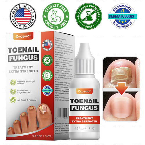 ✅ Made and Shipped from USA | Zvoevo® Toenail Fungus Treatment Extra Strength, Antifungal Solution for Toenail or Fingernail, Triple Action Formula for Remove Fungal, Repair and Renewal Damaged Nails🐞