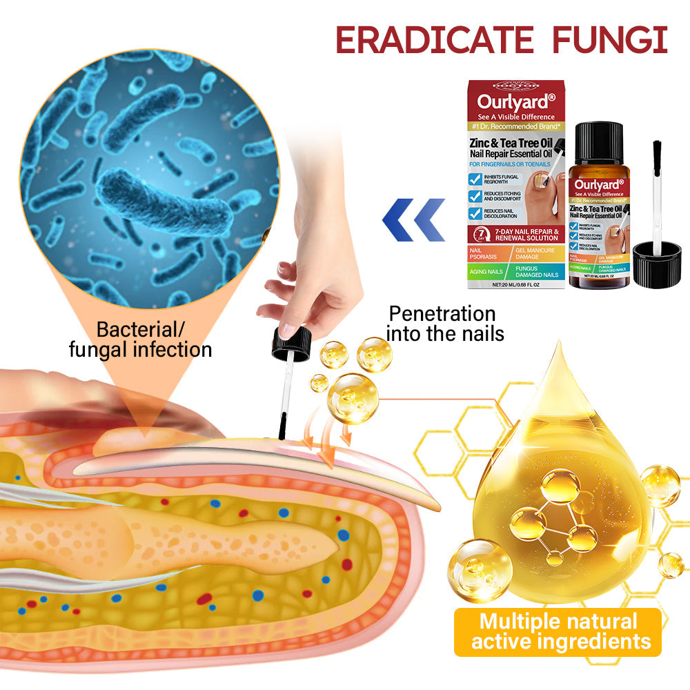 ✅ Made and Shipped from USA | Ourlyard® Zinc & Tea Tree Oil Nail Repair Essential Oil (Comprehensive repair, powerful treatment for all nail disorders)