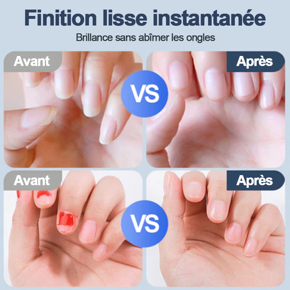 💥 50% DE RÉDUCTION ! ✨ Ponceuse à Ongles Auto - 3 Vitesses Réglables, Silencieuse, LED Integrée pour Soin Précise 💅✨ -Remifa®