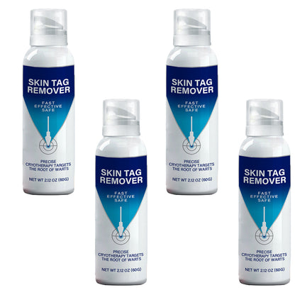 ✅Official Store |Ourlyard® TagRecede Cryo Treatment Spray  | Removes warts and skin tags, suitable for all skin types 💘💘