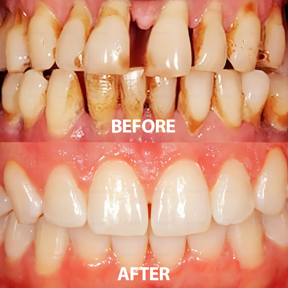 ✅ Made and Shipped from the USA | Rolimey® Transforming Growth Factor-β (TGF-β) Oral Repair Mouthwash 💧