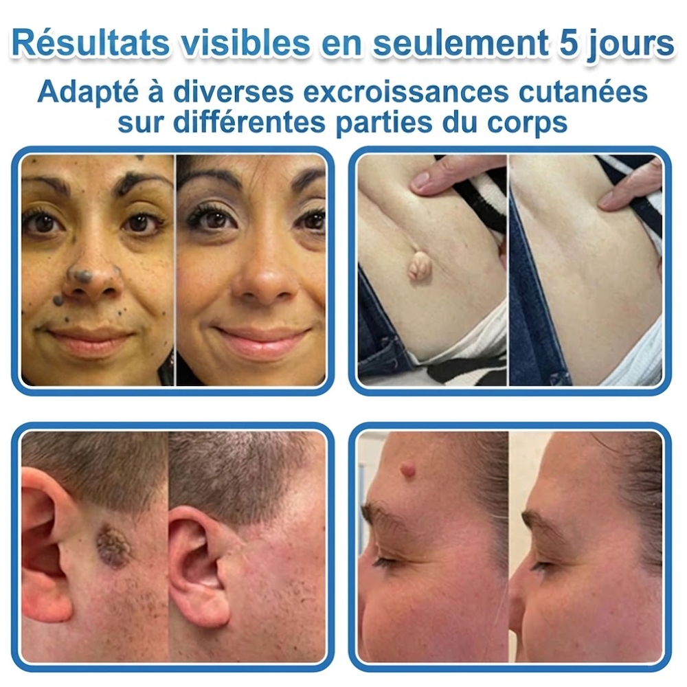 🌿Pansements hydrocolloïdes à micro-aiguilles Celsiora® 2-en-1
