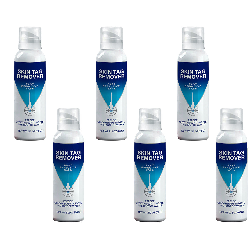 ✅Official Store |Ourlyard® TagRecede Cryo Treatment Spray  | Removes warts and skin tags, suitable for all skin types 💘💘
