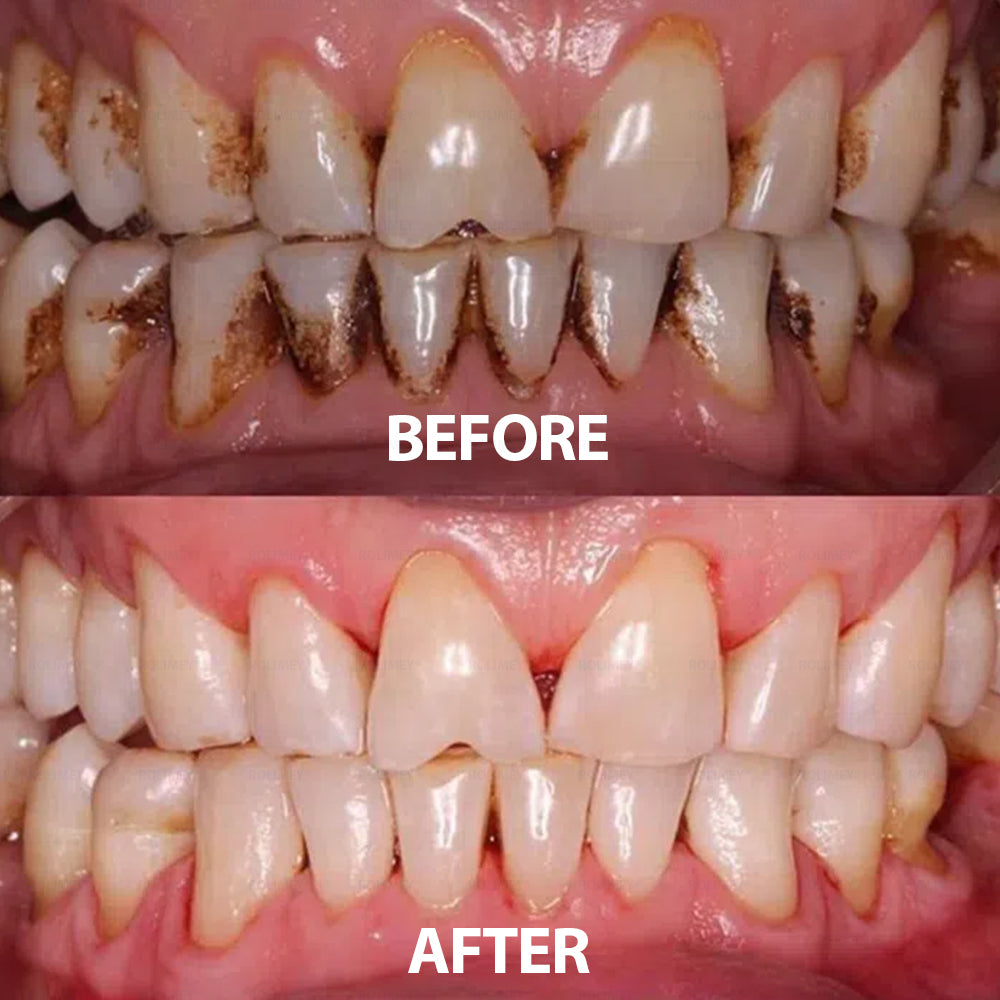 ✅ Made and Shipped from the USA | Rolimey® Transforming Growth Factor-β (TGF-β) Oral Repair Mouthwash 💧