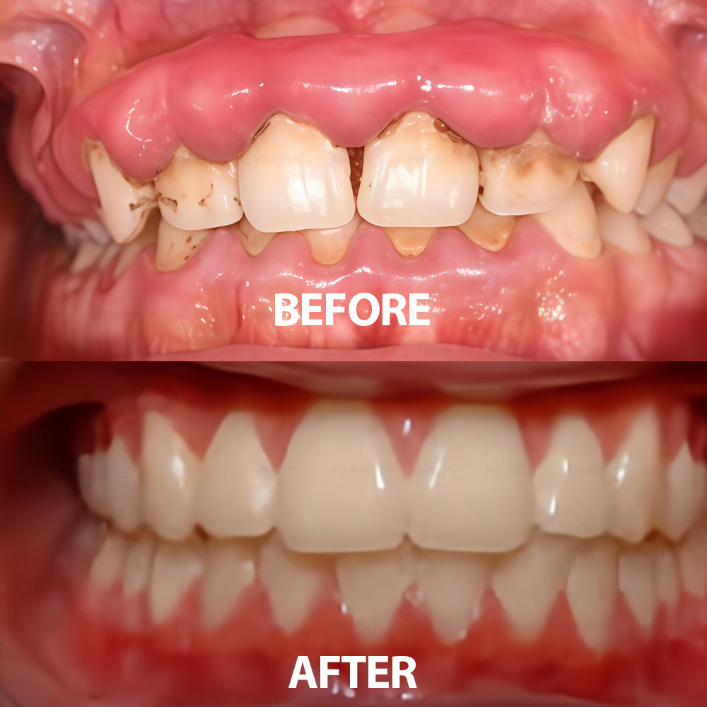 ✅ Made and Shipped from the USA | Rolimey® Transforming Growth Factor-β (TGF-β) Oral Repair Mouthwash 💧