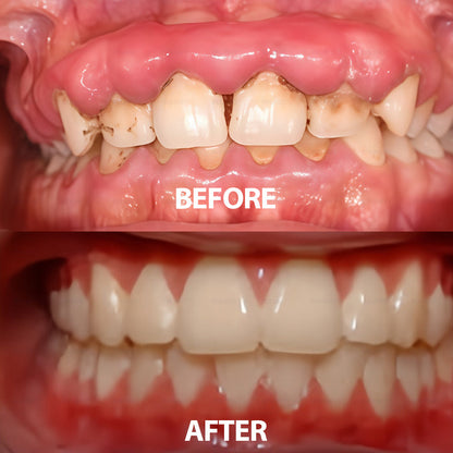 ✅ Made and Shipped from the USA | Rolimey® Transforming Growth Factor-β (TGF-β) Oral Repair Mouthwash 💧
