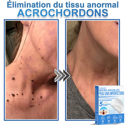 🌿Pansements hydrocolloïdes à micro-aiguilles Celsiora® 2-en-1