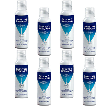 ✅Official Store |Ourlyard® TagRecede Cryo Treatment Spray  | Removes warts and skin tags, suitable for all skin types 💘💘