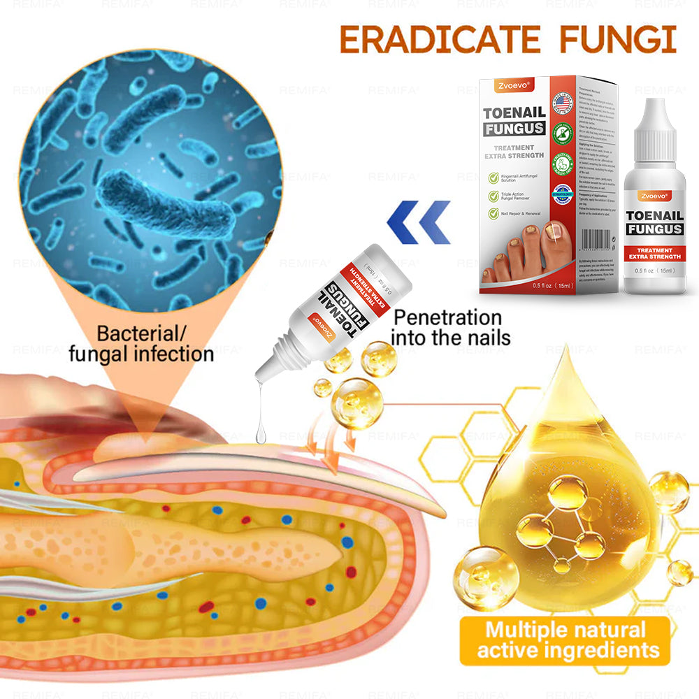 ✅ Made and Shipped from USA | Zvoevo® Toenail Fungus Treatment Extra Strength, Antifungal Solution for Toenail or Fingernail, Triple Action Formula for Remove Fungal, Repair and Renewal Damaged Nails🐞