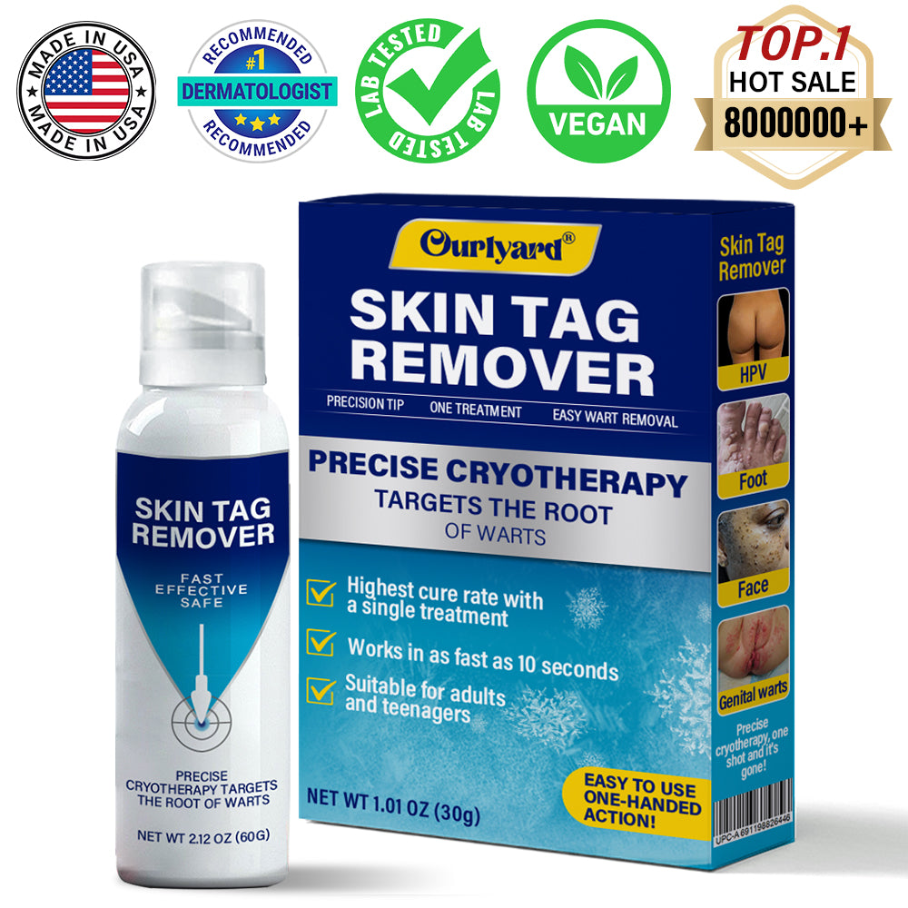 ✅Official Store |Ourlyard® TagRecede Cryo Treatment Spray  | Removes warts and skin tags, suitable for all skin types 💘💘 💘