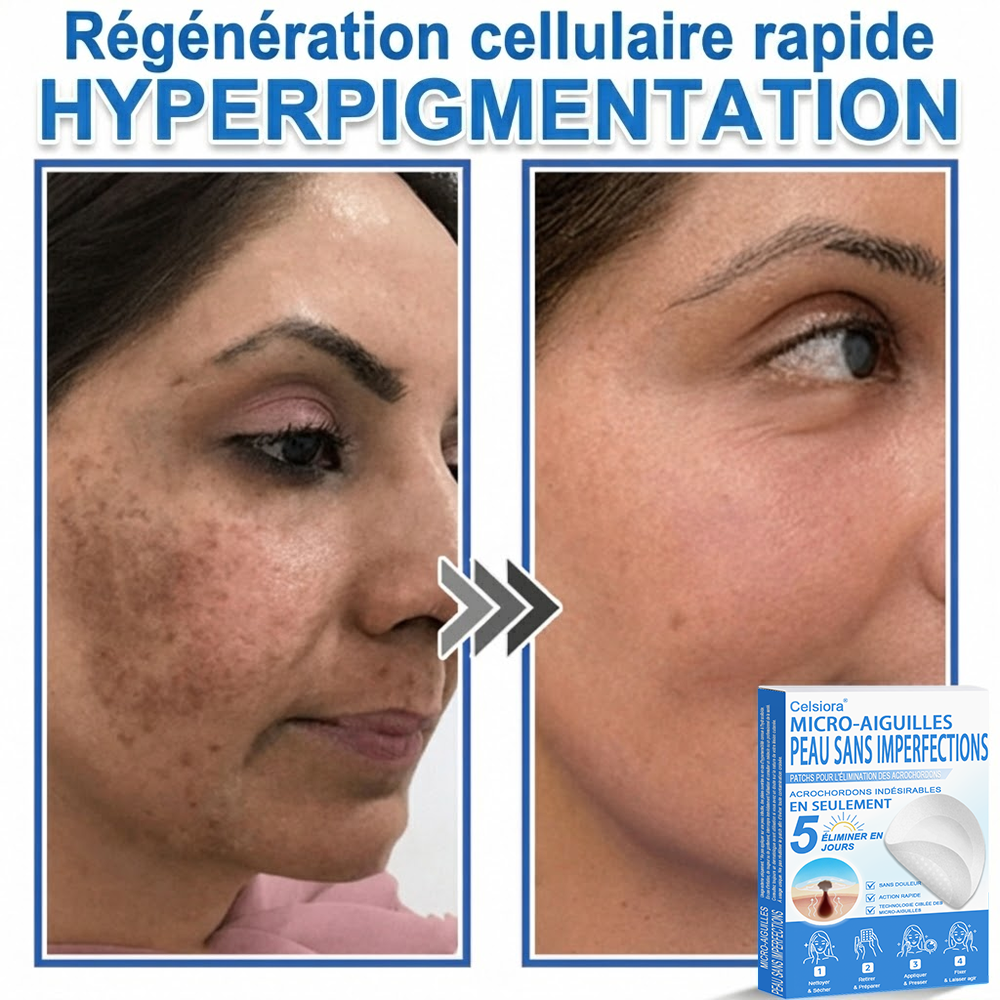 🌿Pansements hydrocolloïdes à micro-aiguilles Celsiora® 2-en-1