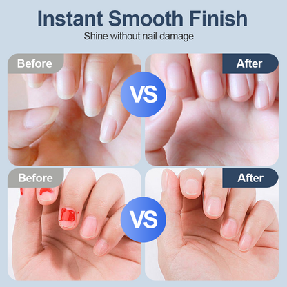 🔥 50% DE RÉDUCTION ! ✨ Ponceuse à Ongles Auto - 3 Vitesses Réglables, Silencieuse, LED Integrée pour Soin Précise ✨ -Remifa®